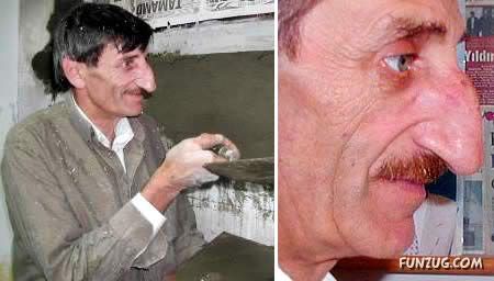 People with 10 Most Extreme Body Parts