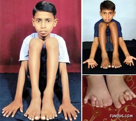 People with 10 Most Extreme Body Parts