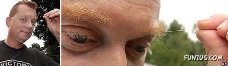 People with 10 Most Extreme Body Parts