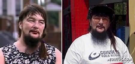 People with 10 Most Extreme Body Parts